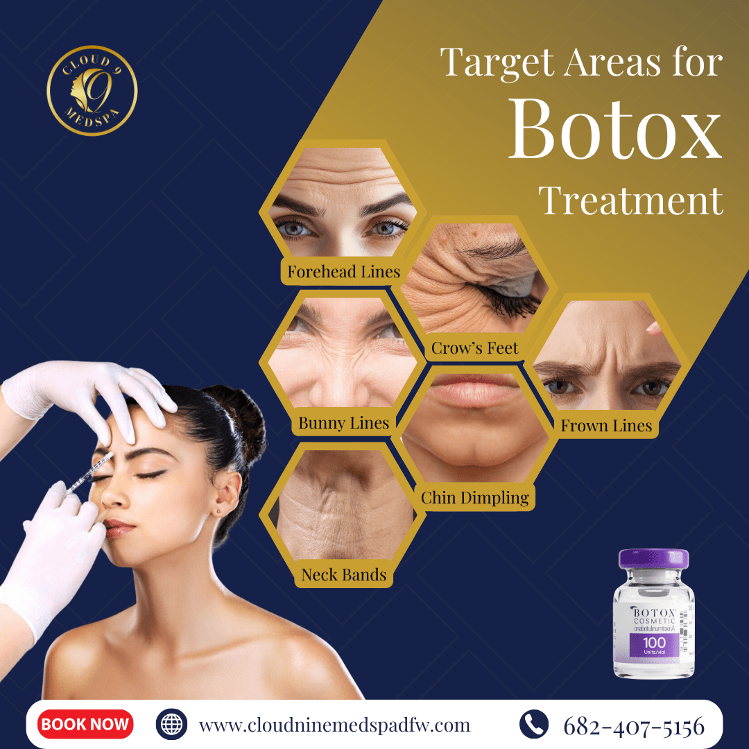 Target Areas for Botox Treatment