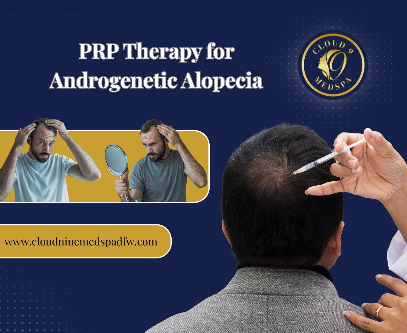 PRP Therapy for Androgenetic Alopecia