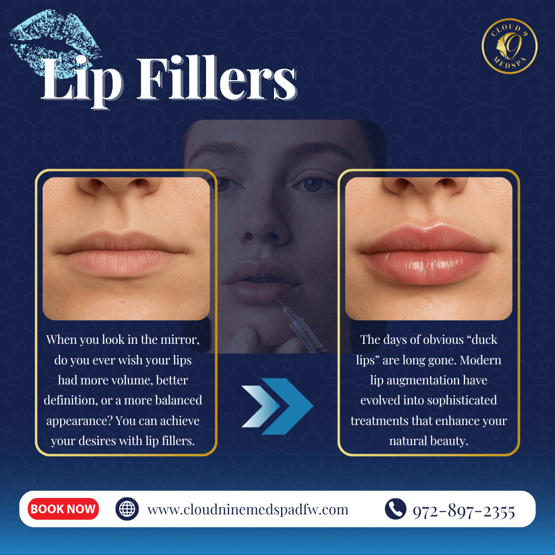 Lip Fillers in Fort Worth, TX