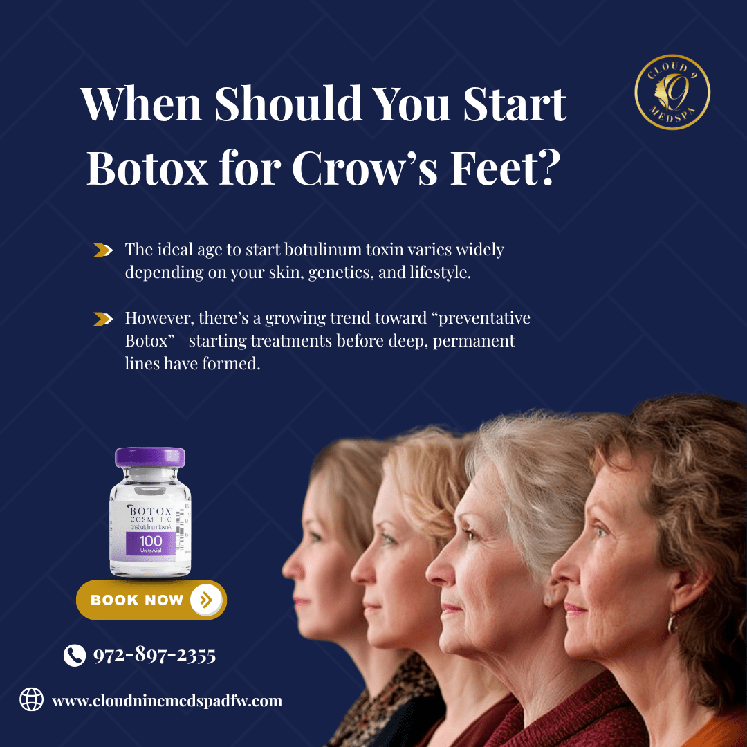 When Should You Start Botox for Crow's Feet?