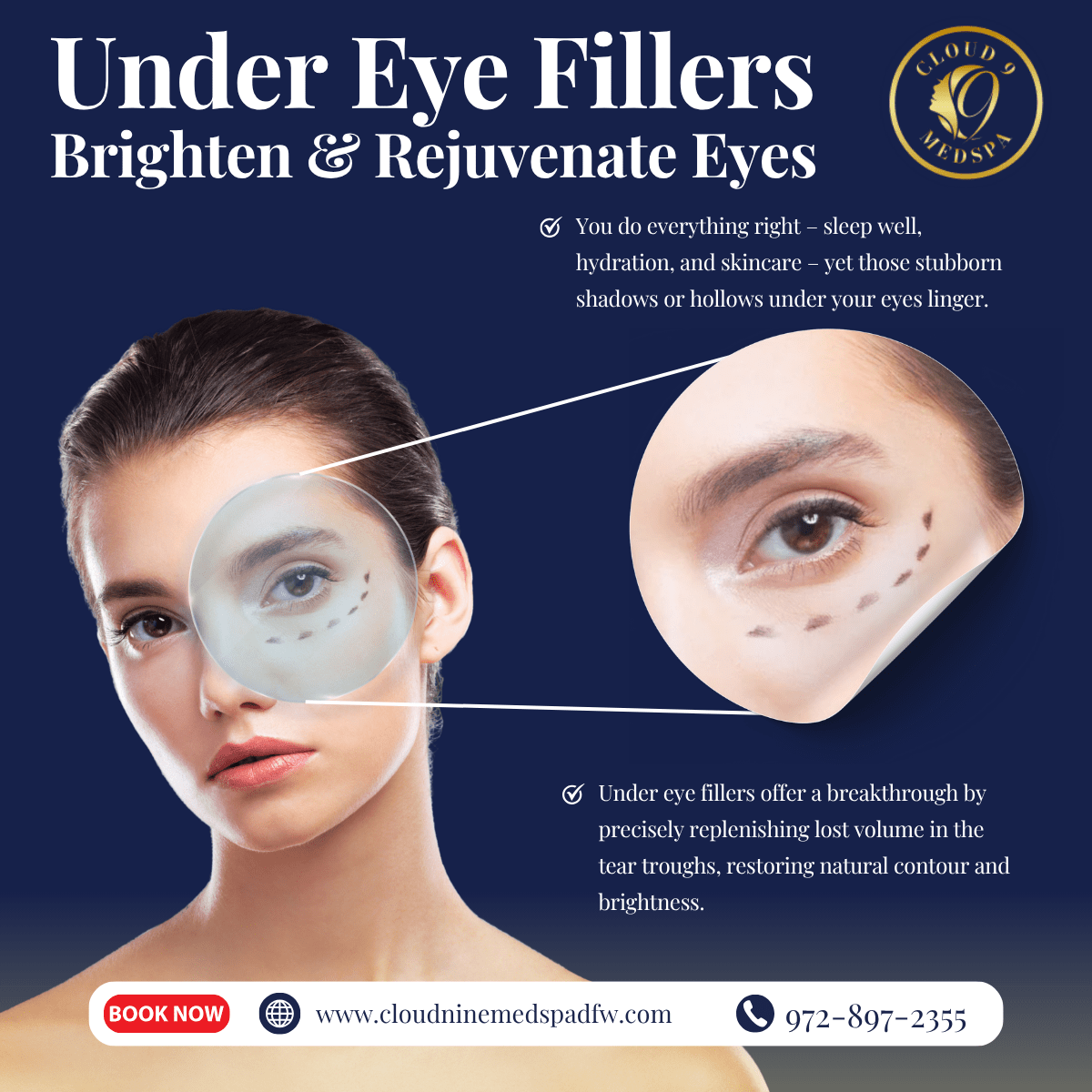 Fillers for Under-Eyes in Fort Worth, TX