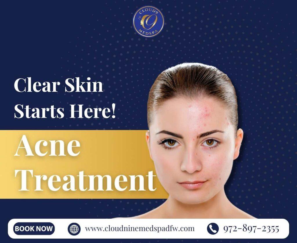 Clear Skin Starts Here | Acne Treatment