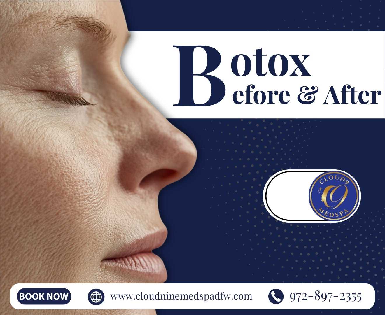 Botox Before & After Results | See the Difference